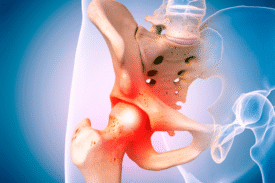 Inflammatory Arthritis: A Comprehensive Review