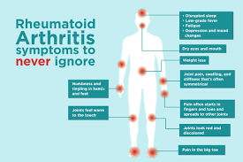 Signs of Rheumatoid Arthritis