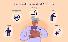 Rheumatoid Arthritis Causes