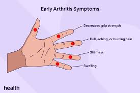 Arthritis in the Fingers
