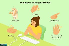 Arthritis in the Fingers