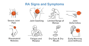 RA