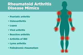 RA Disease