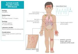 Juvenile Rheumatoid Arthritis