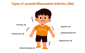 Juvenile Rheumatoid Arthritis