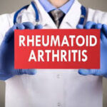 RA Treatments