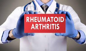 Top 3 RA Treatments to Manage Rheumatoid Arthritis