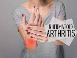 Rheumatoid Arthritis Causes: And How to Prevent It