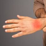 ra rheumatoid arthritis ra disease arthritis and rheumatoid arthritis rheumatoid arthritis disease rheumatologist rheumatoid arthritis symptoms signs of rheumatoid arthritis signs and symptoms of rheumatoid arthritis