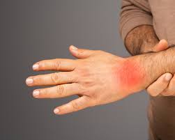 RA Disease: Treatments and Alternatives