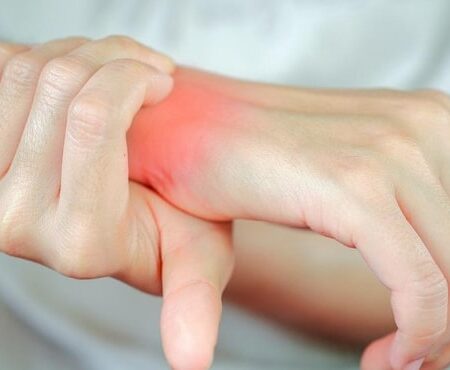 Signs of Rheumatoid Arthritis: See All
